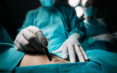 Doctors under pressure as 1 in 4 exceed EU working hour limits